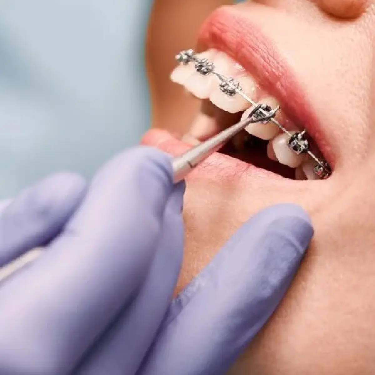 orthodontists web design